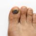 О чем расскажут ваши ногти – определяем болезни по ногтям Точечные вмятины на ногтях